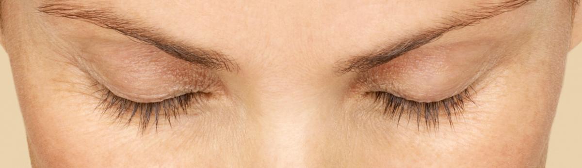 Latisse - Before | InFocus Eye Care